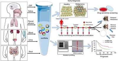 The Value of Circulating Circular RNA in Cancer Diagnosis, Monitoring, Prognosis, and Guiding Treatment